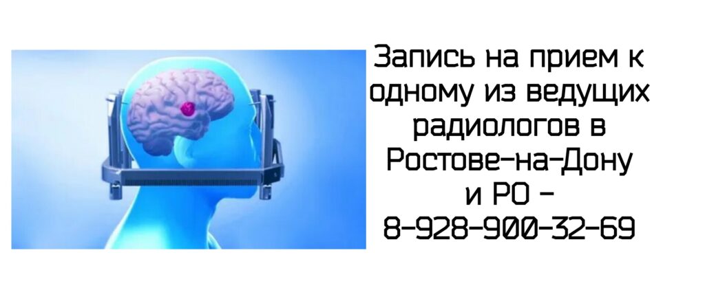 Ростов Джабаров Фархат Расимович - лучевая терапия иногда возможна и при очаговом поражении головного мозга