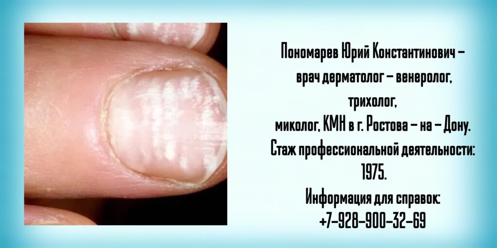 Ведущие дерматологи Ростова -на-Дону - Пономарев Юрий Константинович