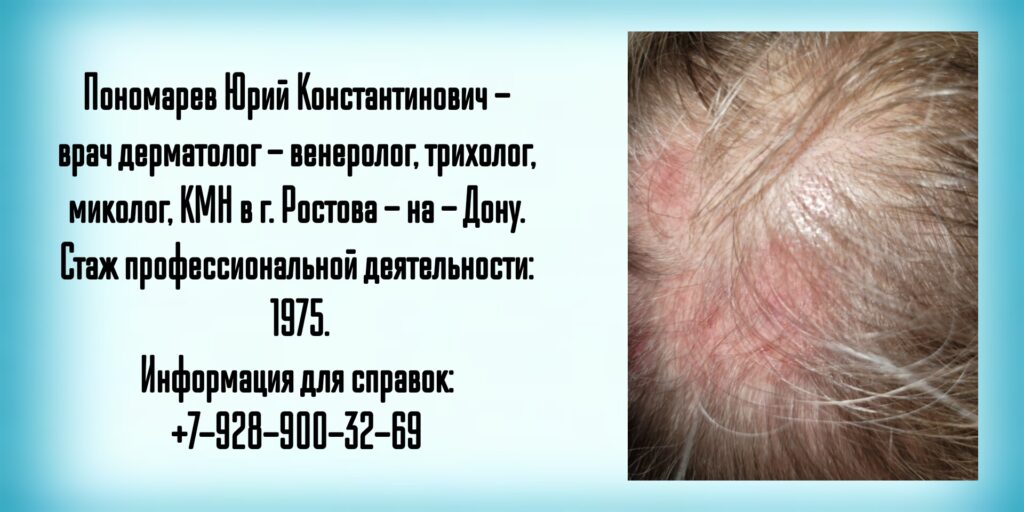 Ведущие дерматологи Ростова -на-Дону - Пономарев Юрий Константинович