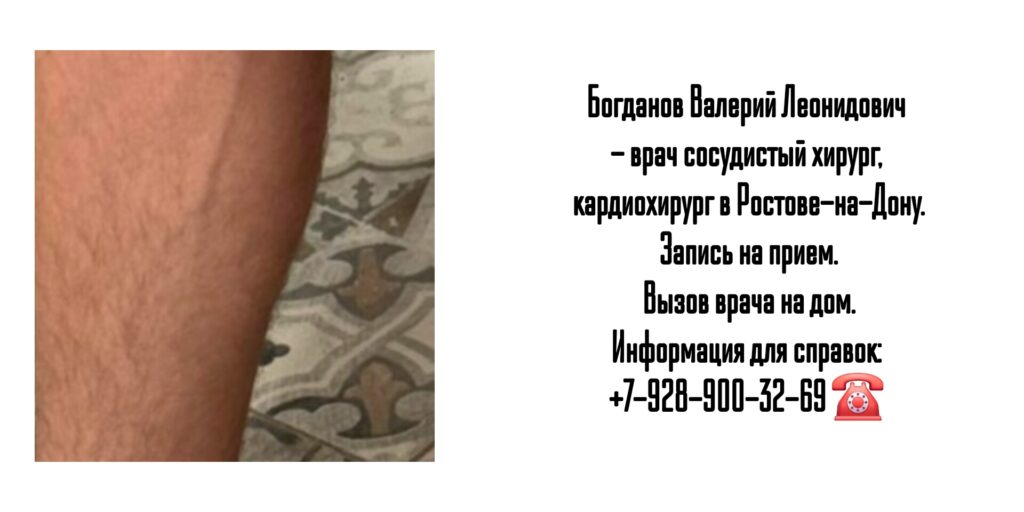 Сосудистый хирург Ростов - Богданов Валерий Леонидович
