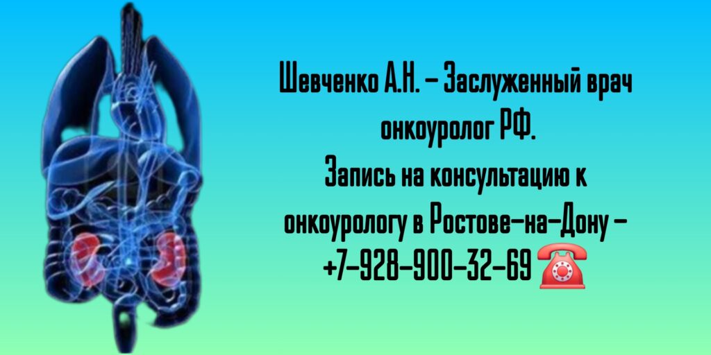 Ростов онкоуролог - Шевченко Алексей Николаевич 