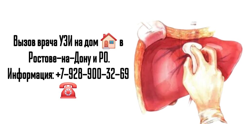 УЗИ печени на дому - Ростов-на-Дону