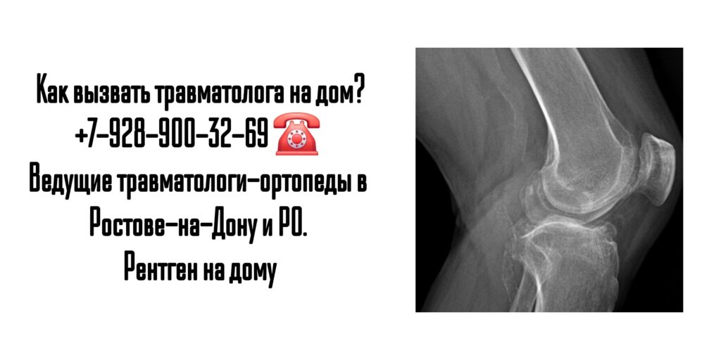 Вызов травматолога на дом в Ростове и РО