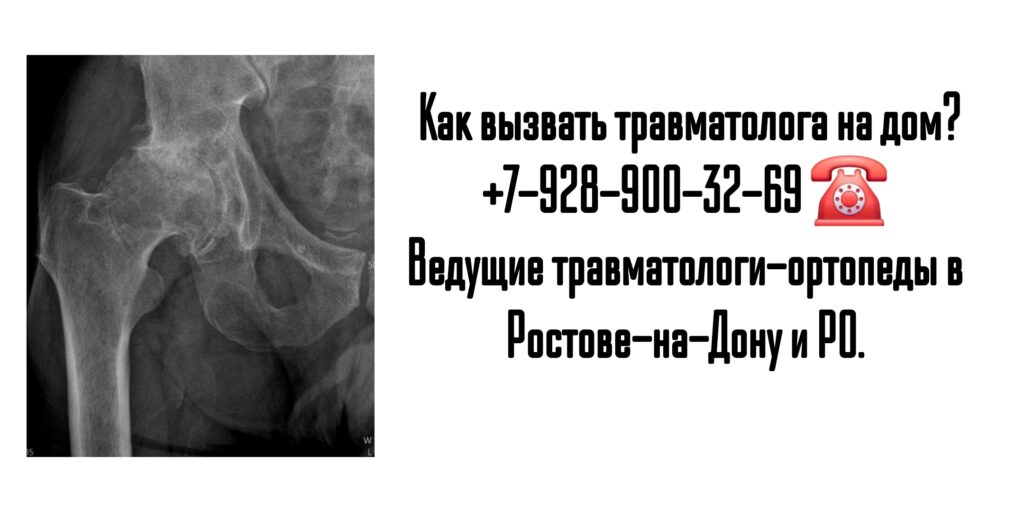 Вызов травматолога на дом в Ростове и РО