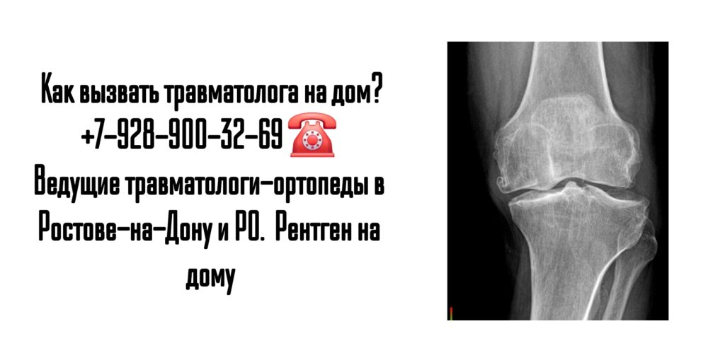 Вызов травматолога на дом в Ростове и РО