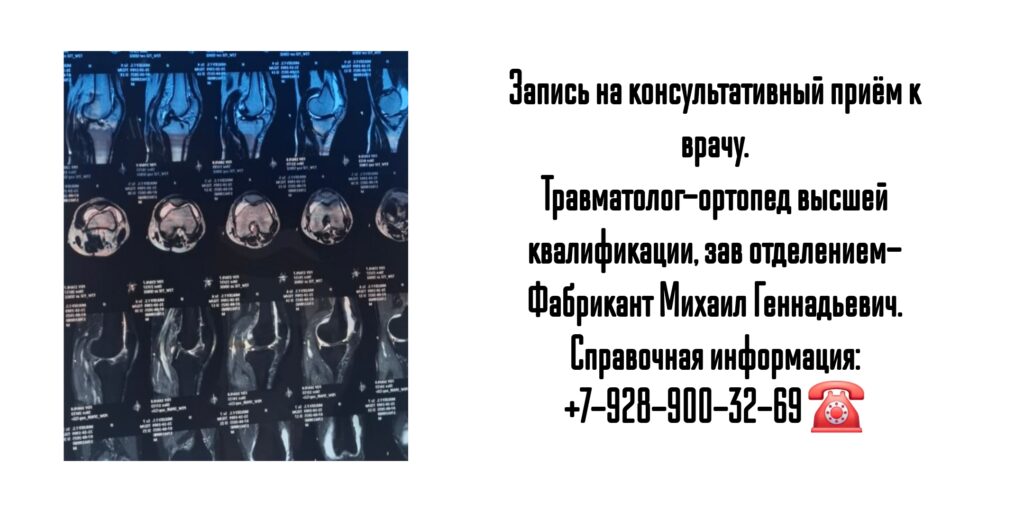 Фабрикант Михаил Геннадьевич- консультация травматолога в Ростове-на-Дону