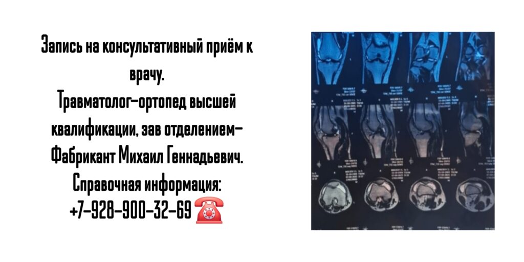 Фабрикант Михаил Геннадьевич- консультация травматолога в Ростове-на-Дону
