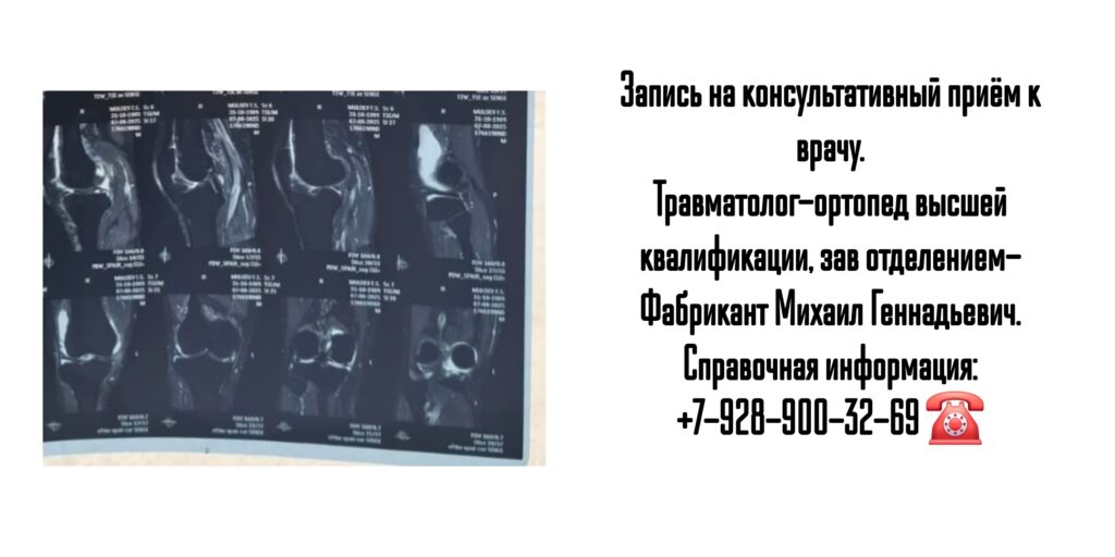 Фабрикант Михаил Геннадьевич- консультация травматолога в Ростове-на-Дону