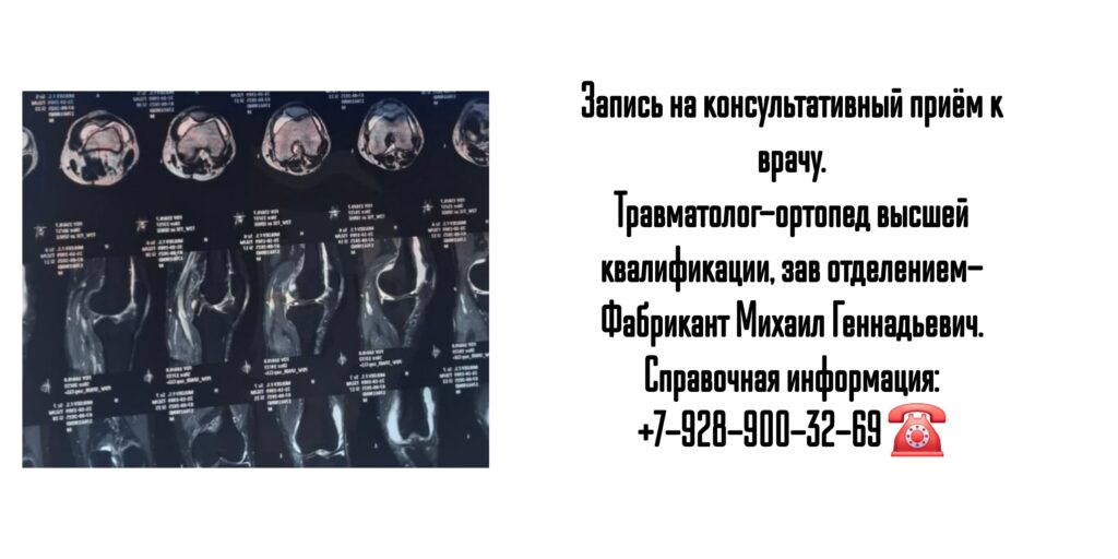Фабрикант Михаил Геннадьевич- консультация травматолога в Ростове-на-Дону