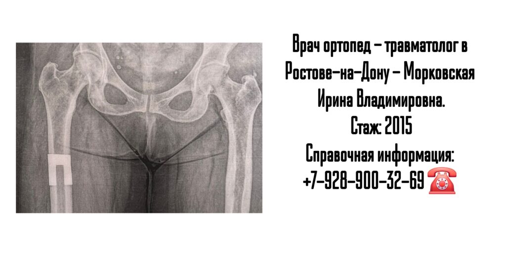 Морковская Ирина Владимировна - травматология и ортопедия