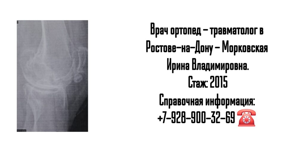 Морковская Ирина Владимировна - травматология и ортопедия