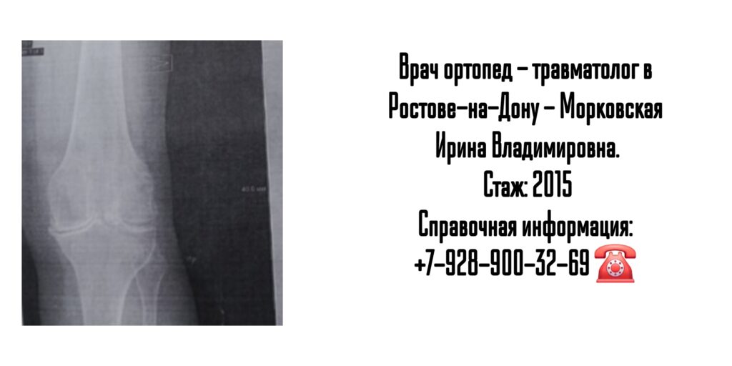 Морковская Ирина Владимировна - травматология и ортопедия