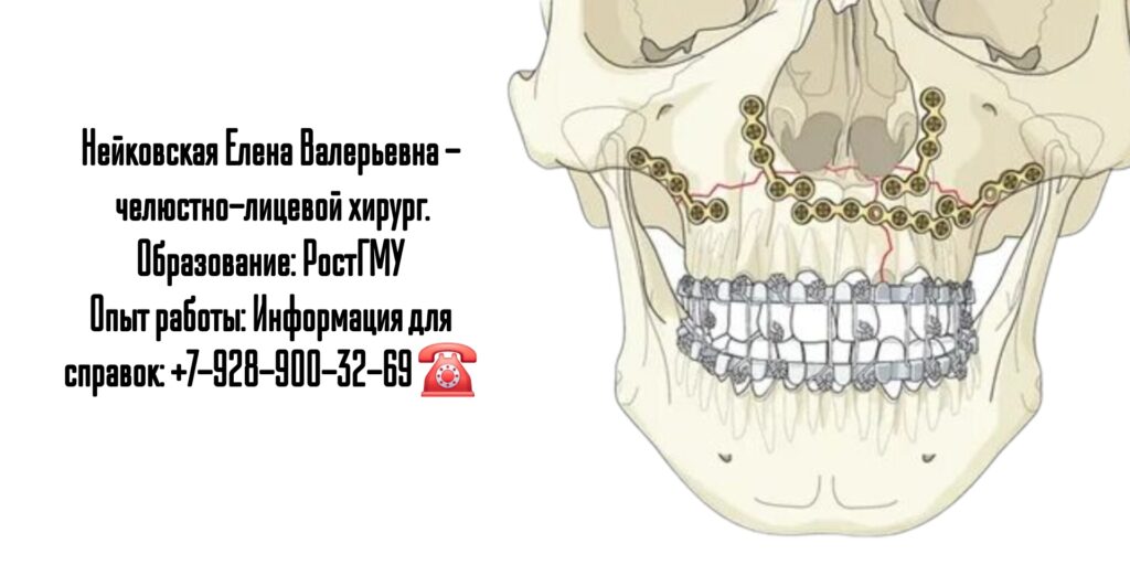 Нейковская Елена Валерьевна - челюстно-лицевой хирург в Ростове-на-Дону