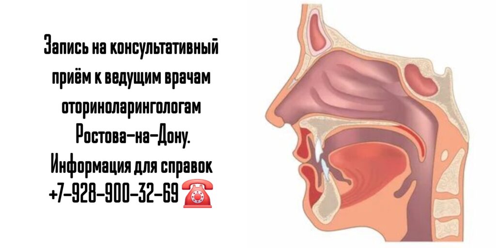 ЛОР - врач в Ростове-на-Дону- Кондрашев Павел Александрович