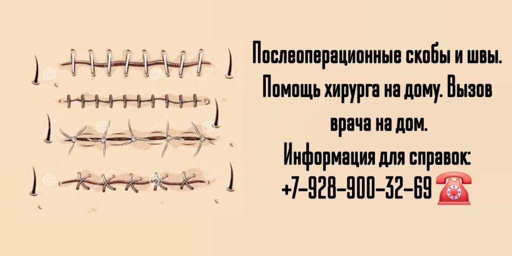 Снятие швов после операции на дому в Ростове-на-Дону