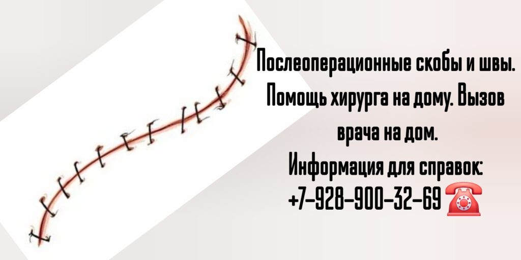 Снятие швов после операции на дому в Ростове-на-Дону