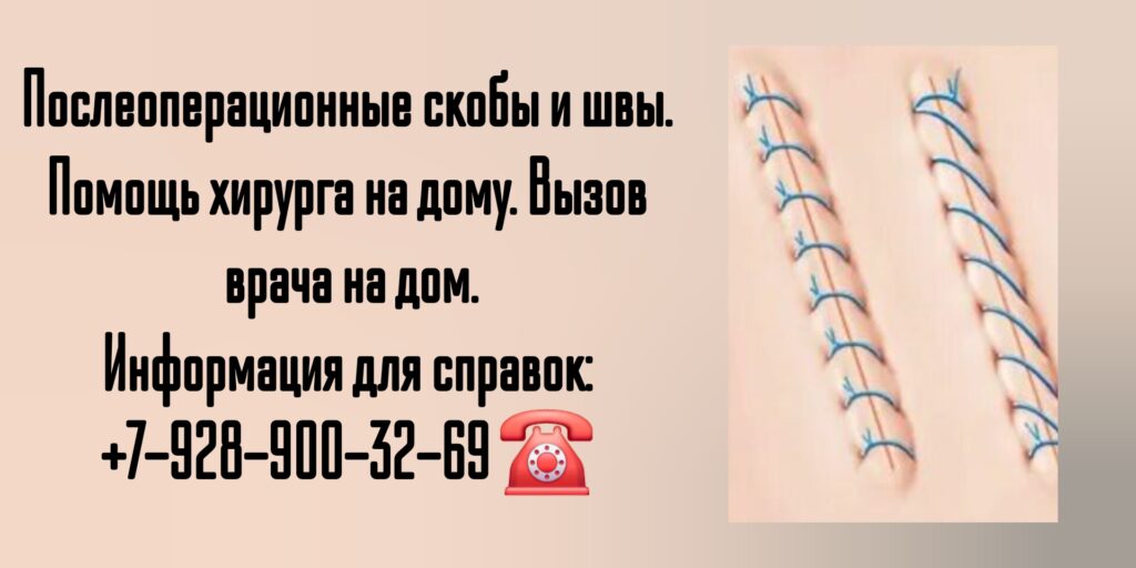 Снятие швов после операции на дому в Ростове-на-Дону