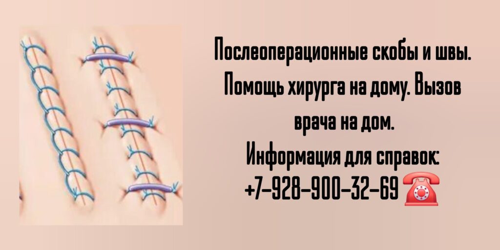 Снятие швов после операции на дому в Ростове-на-Дону