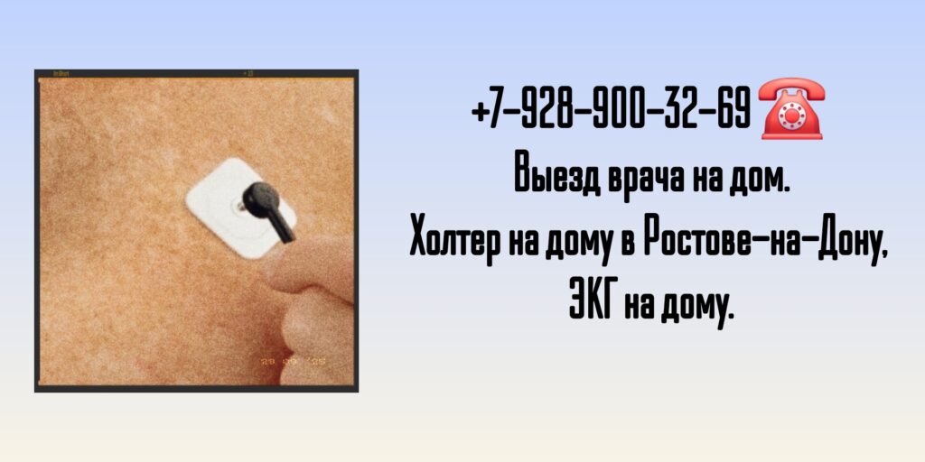 ЭКГ на дом Ростов на дону