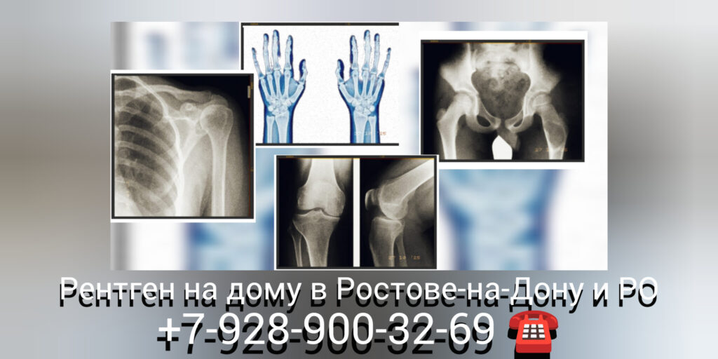 Рентген в Ростове-на-Дону и РО - на дому