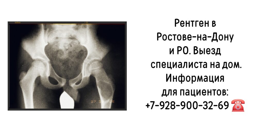Рентген в Ростове-на-Дону и РО - на дому