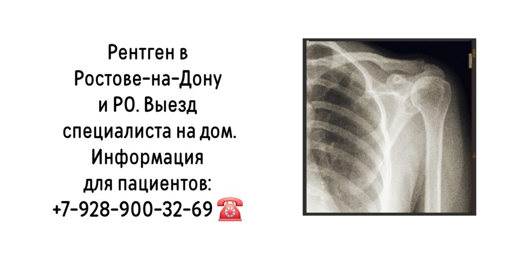 Рентген в Ростове-на-Дону и РО - на дому