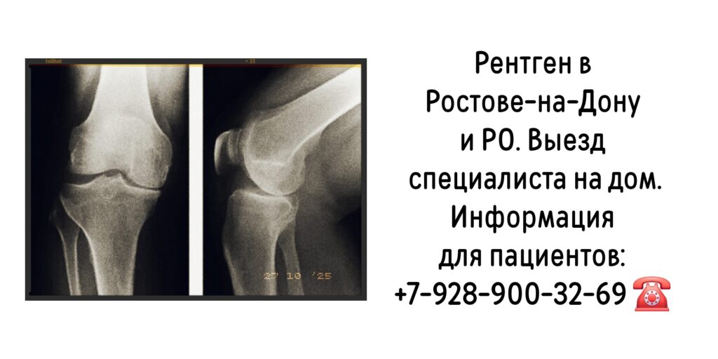 Рентген в Ростове-на-Дону и РО - на дому