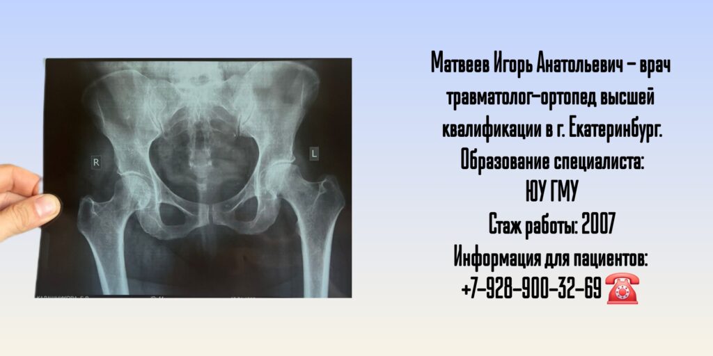 Матвеев Игорь Анатольевич - травматолог-ортопед в Екатеринбурге
