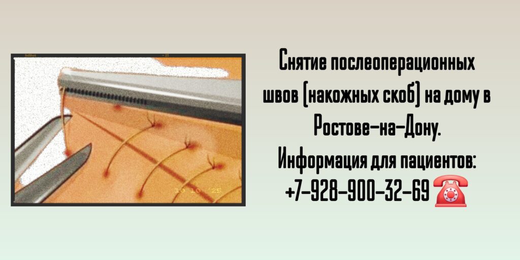 Снятие послеоперационных швов в травматологии - выезд хирурга на дом