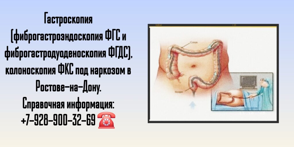 Колоноскопия под наркозом в Ростове-на-Дону - Губин Алексей Леонидович 