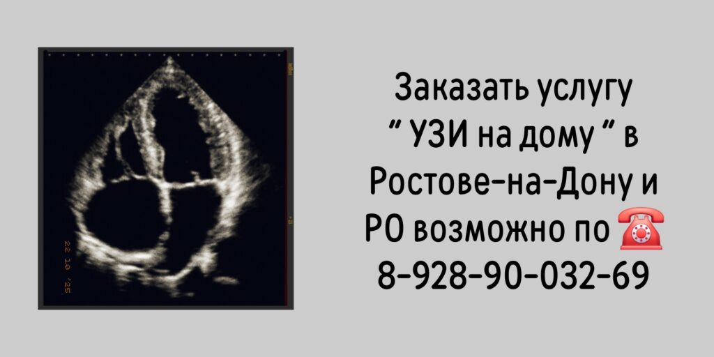 Ростов вызов врача на дом- УЗИ на дому