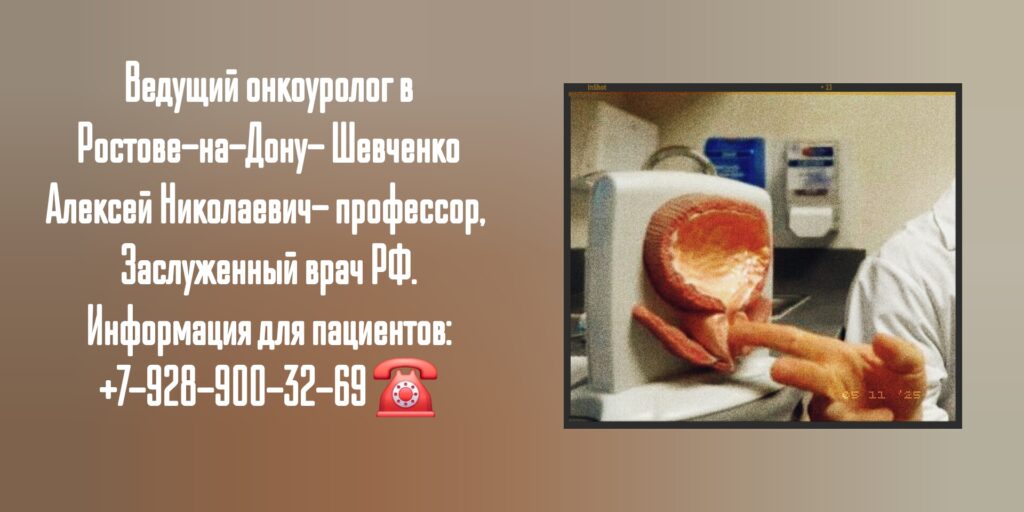 Шевченко Алексей Николаевич - Консультация онколога-уролога в Ростове-на-Дону