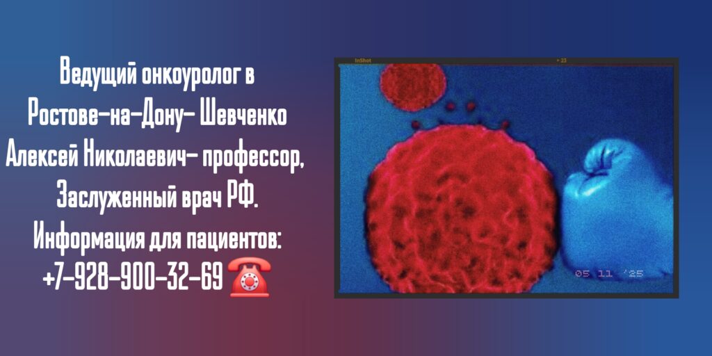 Шевченко Алексей Николаевич - Консультация онколога-уролога в Ростове-на-Дону