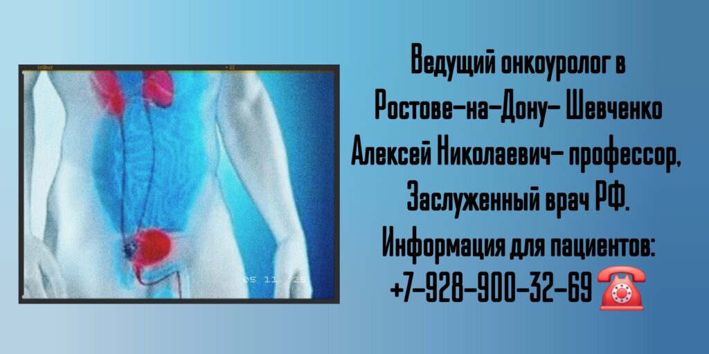 Шевченко Алексей Николаевич - Консультация онколога-уролога в Ростове-на-Дону