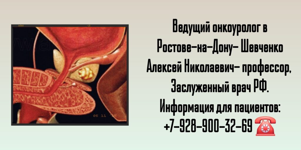 Шевченко Алексей Николаевич - Консультация онколога-уролога в Ростове-на-Дону