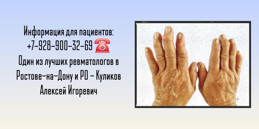 Ростов - ведущий ревматолог - Куликов Алексей Игоревич