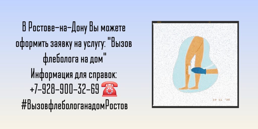 Как вызвать флеболога на дом в Ростове-на-Дону?