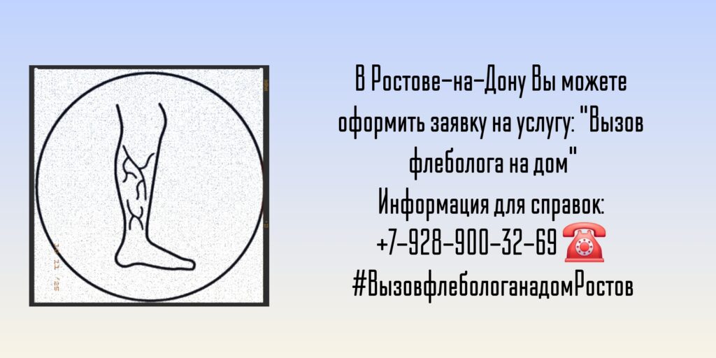 Как вызвать флеболога на дом в Ростове-на-Дону?