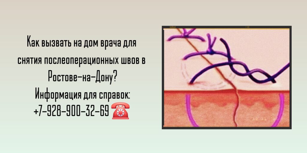 Снятие швов после операции на дому Ростов-на-Дону