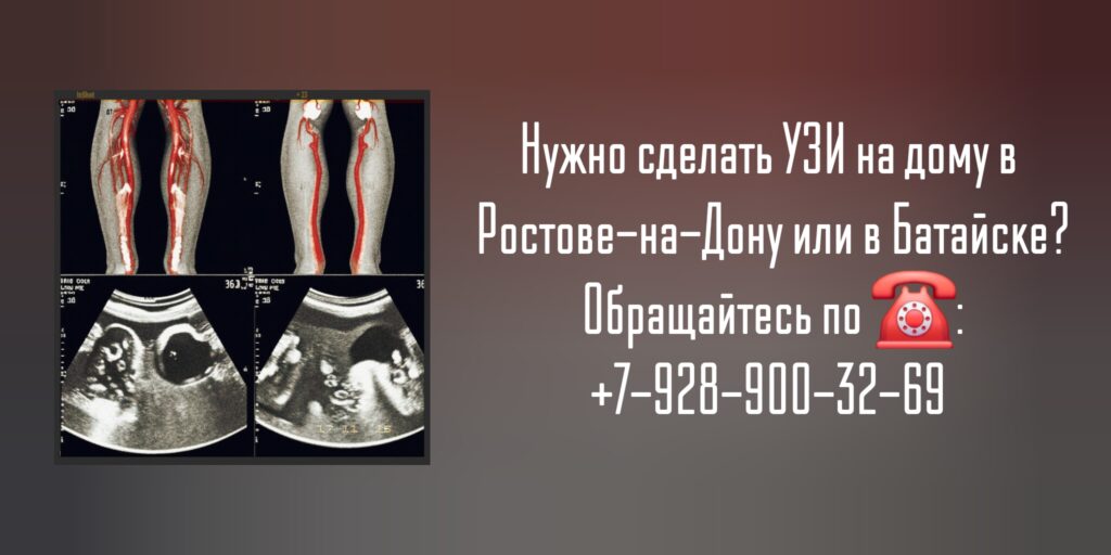 #узинадомростов
#вызовврачаузинадомростов