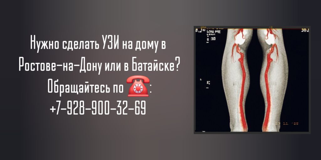 УЗИ Ростов-на-Дону - вызов на дом врача