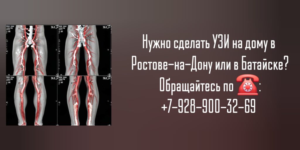 УЗИ Ростов-на-Дону - вызов на дом врача