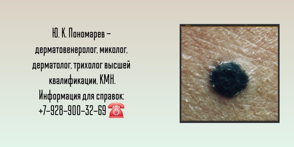 Пономарев Юрий Константинович - дерматолог - дерматовенеролог Ростов