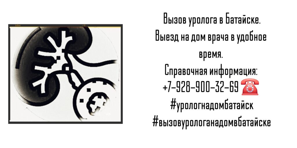 Вызов на дом уролога в Батайске