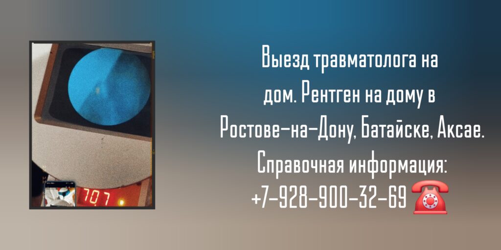 Вызов травматолога на дом - рентген на дому в Ростове-на-Дону Батайске Аксае