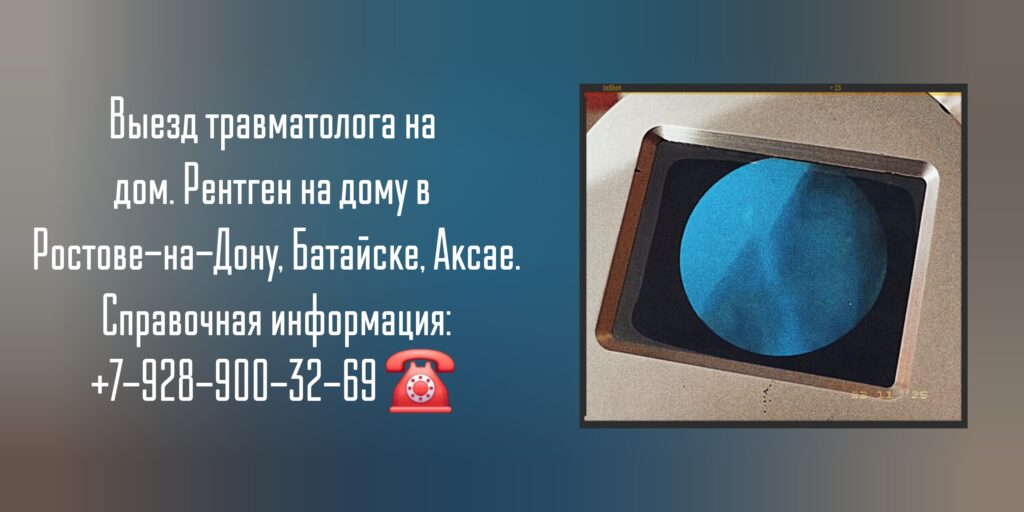Вызов травматолога на дом - рентген на дому в Ростове-на-Дону Батайске Аксае
