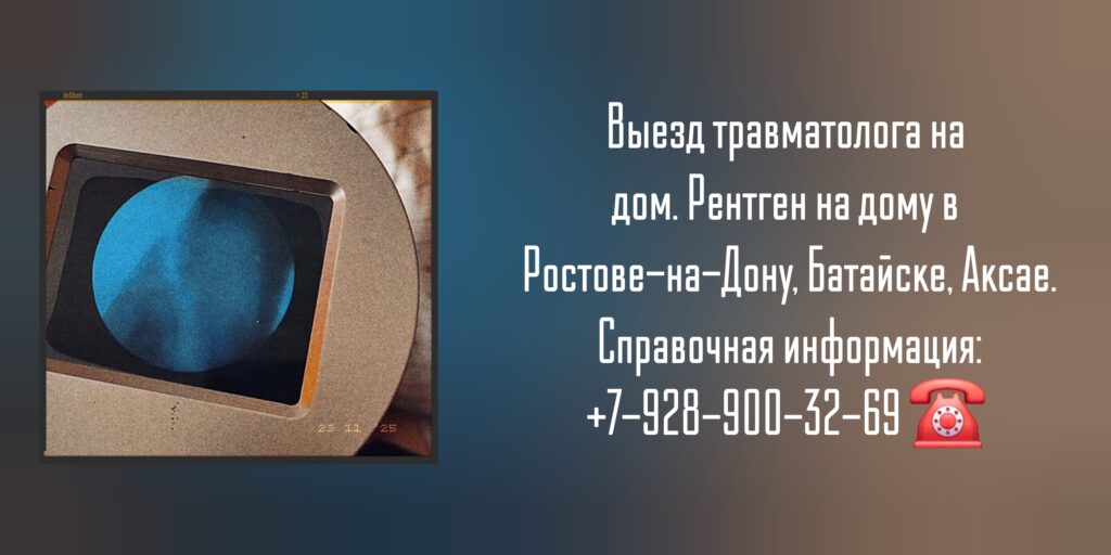 Вызов травматолога на дом - рентген на дому в Ростове-на-Дону Батайске Аксае