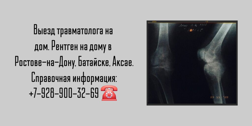 Вызов травматолога на дом - рентген на дому в Ростове-на-Дону Батайске Аксае