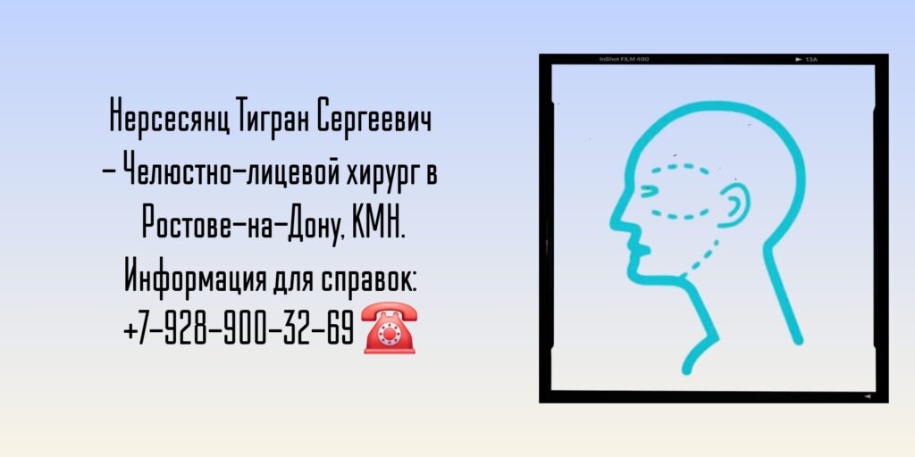 Нерсесянц Тигран Сергеевич- врач челюстно-лицевой хирург