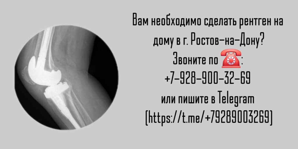 Рентген Ростов-на-Дону - Вызов на дом врача